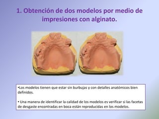 1. Obtención de dos modelos por medio de
        impresiones con alginato.




•Los modelos tienen que estar sin burbujas y con detalles anatómicos bien
definidos.

• Una manera de identificar la calidad de los modelos es verificar si las facetas
de desgaste encontradas en boca están reproducidas en los modelos.
 