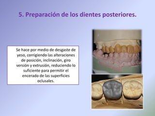 5. Preparación de los dientes posteriores.




Se hace por medio de desgaste de
yeso, corrigiendo las alteraciones
   de posición, inclinación, giro
versión y extrusión, reduciendo lo
    suficiente para permitir el
   encerado de las superficies
            oclusales.
 