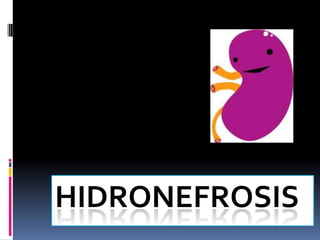HIDRONEFROSIS
 