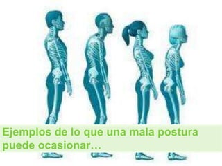 Ejemplos de lo que una mala postura
puede ocasionar…