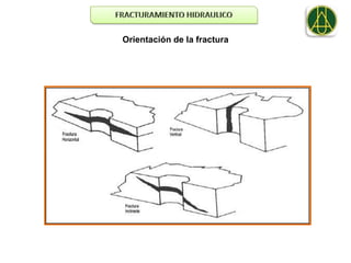 Orientación de la fractura
 