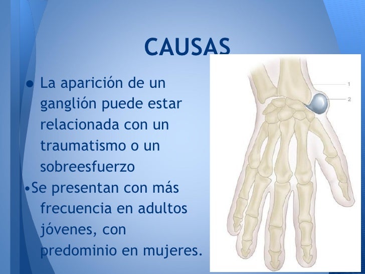 La crema el mar muerto la psoriasis