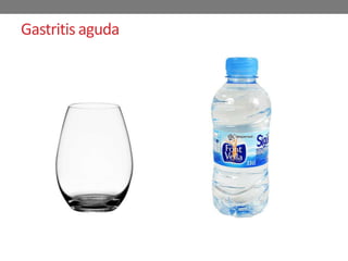 Gastritis aguda
 