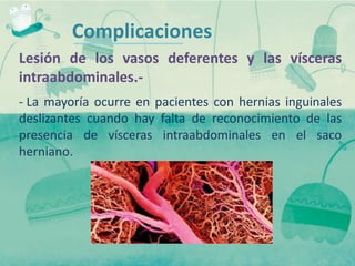 Complicaciones
Lesión de los vasos deferentes y las vísceras
intraabdominales.-
- La mayoría ocurre en pacientes con hernias inguinales
deslizantes cuando hay falta de reconocimiento de las
presencia de vísceras intraabdominales en el saco
herniano.
 