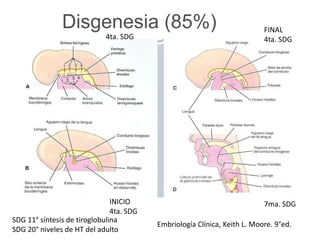 4ta. SDG
INICIO
4ta. SDG
FINAL
4ta. SDG
7ma. SDG
Embriología Clínica, Keith L. Moore. 9°ed.
Disgenesia (85%)
SDG 11° síntesis de tiroglobulina
SDG 20° niveles de HT del adulto
 