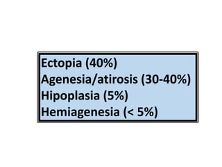 Ectopia (40%)
Agenesia/atirosis (30-40%)
Hipoplasia (5%)
Hemiagenesia (< 5%)
 