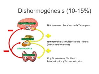 Dishormogénesis (10-15%)
TRH Hormona Liberadora de la Tirotropina
TSH Hormona Estimuladora de la Tiroides
(Tiroxina o tirotropina)
T3 y T4 Hormonas Tiroideas
Triyodotironina y Tetrayodotironina
adenohipófisis
 