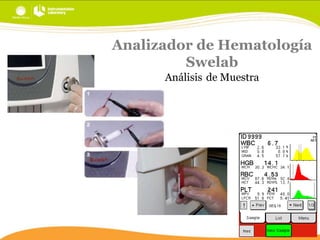 Analizador de Hematología
Swelab
Análisis de Muestra

 