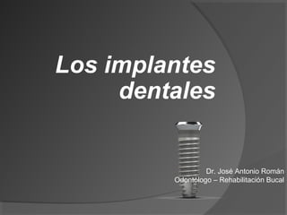 Los implantes
     dentales


                  Dr. José Antonio Román
         Odontólogo – Rehabilitación Bucal
 