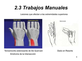 9
2.3 Trabajos Manuales
Lesiones que afectan a las extremidades superiores
Tenosinovitis estenosante de De Quervain
Síndro...