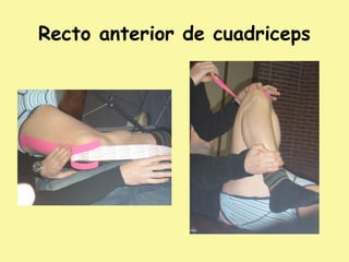 Recto anterior de cuadriceps
 