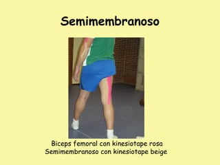 Semimembranoso
Biceps femoral con kinesiotape rosa
Semimembranoso con kinesiotape beige
 