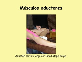 Músculos aductores
Aductor corto y largo con kinesiotape beige
 