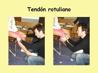 Tendón rotuliano
 