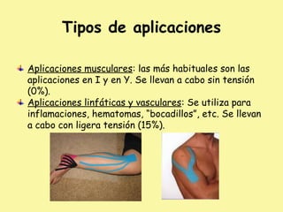 Tipos de aplicaciones
Aplicaciones musculares: las más habituales son las
aplicaciones en I y en Y. Se llevan a cabo sin tensión
(0%).
Aplicaciones linfáticas y vasculares: Se utiliza para
inflamaciones, hematomas, “bocadillos”, etc. Se llevan
a cabo con ligera tensión (15%).
 