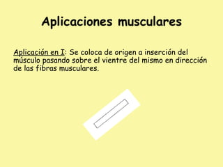 Aplicaciones musculares
Aplicación en I: Se coloca de origen a inserción del
músculo pasando sobre el vientre del mismo en dirección
de las fibras musculares.
 