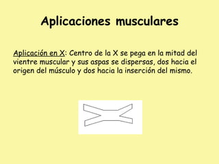 Aplicaciones musculares
Aplicación en X: Centro de la X se pega en la mitad del
vientre muscular y sus aspas se dispersas, dos hacia el
origen del músculo y dos hacia la inserción del mismo.
 