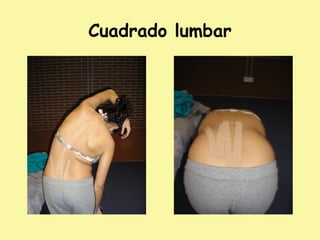 Cuadrado lumbar
 
