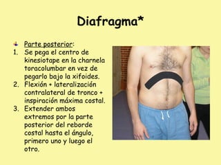 Diafragma*
Parte posterior:
1. Se pega el centro de
kinesiotape en la charnela
toracolumbar en vez de
pegarlo bajo la xifoides.
2. Flexión + lateralización
contralateral de tronco +
inspiración máxima costal.
3. Extender ambos
extremos por la parte
posterior del reborde
costal hasta el ángulo,
primero uno y luego el
otro.
 