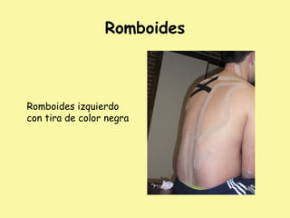 Romboides
Romboides izquierdo
con tira de color negra
 