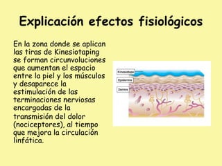 Explicación efectos fisiológicos
En la zona donde se aplican
las tiras de Kinesiotaping
se forman circunvoluciones
que aumentan el espacio
entre la piel y los músculos
y desaparece la
estimulación de las
terminaciones nerviosas
encargadas de la
transmisión del dolor
(nociceptores), al tiempo
que mejora la circulación
linfática.
 