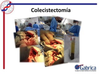Colecistectomía
 