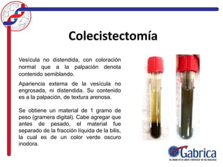 Colecistectomía
Vesícula no distendida, con coloración
normal que a la palpación denota
contenido semiblando.
Apariencia externa de la vesícula no
engrosada, ni distendida. Su contenido
es a la palpación, de textura arenosa.
Se obtiene un material de 1 gramo de
peso (gramera digital). Cabe agregar que
antes de pesado, el material fue
separado de la fracción líquida de la bilis,
la cual es de un color verde oscuro
inodora.
 