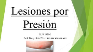 Lesiones por
Presión
NUR 2320-0
Prof. Daisy Soto Pérez, RN, BSN, MSN, CNI, CNS
 