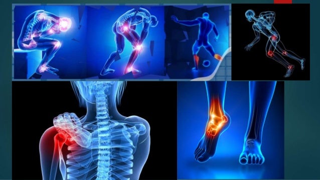 Resultado de imagen para imagenes de lesiones deportivas agudas
