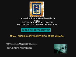 SEGUNDA ESPECIALIZACION
ORTODONCIA Y ORTOPEDIA MAXILAR
Universidad Inca Garcilaso de la
Vega
CURSO DE CEFALOMETRIA
TEMA: ANÁLISIS CEFALOMETRICO DE MCNAMARATEMA: ANÁLISIS CEFALOMETRICO DE MCNAMARA
C.D Annushka Malpartida Caviedes.
ESTUDIANTE POSTGRADO
 