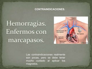 CONTRAINDICACIONES.




Las contraindicaciones realmente
son pocas, pero se debe tener
mucho cuidado al aplicar los
magnetos.
 