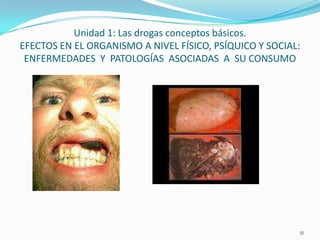 Unidad 1: Las drogas conceptos básicos.
EFECTOS EN EL ORGANISMO A NIVEL FÍSICO, PSÍQUICO Y SOCIAL:
 ENFERMEDADES Y PATOLOGÍAS ASOCIADAS A SU CONSUMO




                                                         51
 