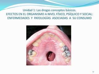 Unidad 1: Las drogas conceptos básicos.
EFECTOS EN EL ORGANISMO A NIVEL FÍSICO, PSÍQUICO Y SOCIAL:
 ENFERMEDADES Y PATOLOGÍAS ASOCIADAS A SU CONSUMO




                                                         57
 