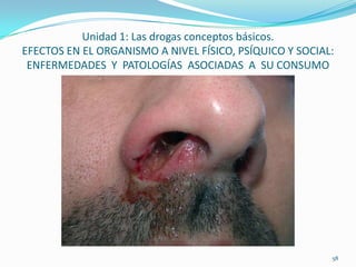 Unidad 1: Las drogas conceptos básicos.
EFECTOS EN EL ORGANISMO A NIVEL FÍSICO, PSÍQUICO Y SOCIAL:
 ENFERMEDADES Y PATOLOGÍAS ASOCIADAS A SU CONSUMO




                                                         58
 