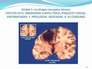 Unidad 1: Las drogas conceptos básicos.
EFECTOS EN EL ORGANISMO A NIVEL FÍSICO, PSÍQUICO Y SOCIAL:
 ENFERMEDADES Y PATOLOGÍAS ASOCIADAS A SU CONSUMO




                                                         59
 