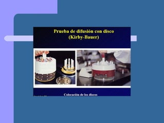 Presentación metodo de kirby bauer