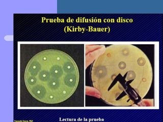 Presentación metodo de kirby bauer