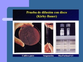 Presentación metodo de kirby bauer