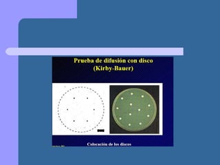 Presentación metodo de kirby bauer