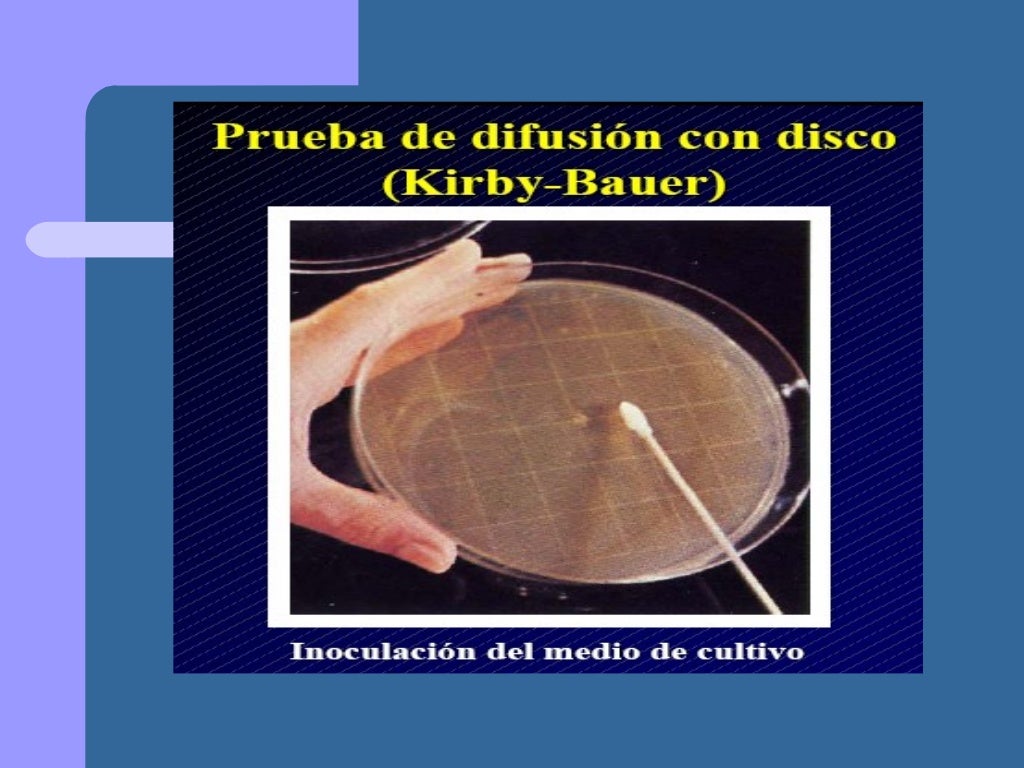 Presentación metodo de kirby bauer