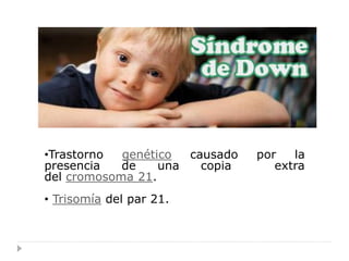 •Trastorno  genético  causado   por   la
presencia   de    una   copia      extra
del cromosoma 21.
• Trisomía del par 21.
 