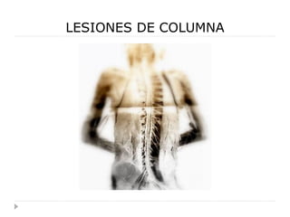 LESIONES DE COLUMNA
 
