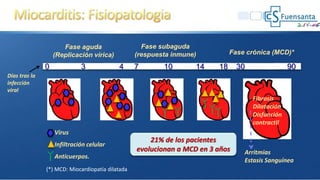 0 3 4 7 10 14 18 30 90
Fibrosis
Dilatación
Disfunción
contractil
Días tras la
infección
viral
Virus
Infiltración celular
Anticuerpos.
(*) MCD: Miocardiopatía dilatada
Fase aguda
(Replicación vírica)
Fase subaguda
(respuesta inmune) Fase crónica (MCD)*
Arritmias
Estasis Sanguínea
21% de los pacientes
evolucionan a MCD en 3 años
 
