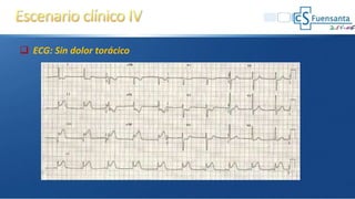  ECG: Sin dolor torácico
 