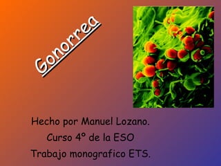 Gonorrea Hecho por Manuel Lozano. Curso 4º de la ESO Trabajo monografico ETS. 