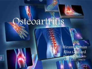 Osteoartritis
Hirami Román
Elisa Gaillard
Prof. Ana Delgado
ENFE 2233 - 59873
 