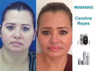 Caroline
Reyes
RESULTADOSRESULTADOS
 