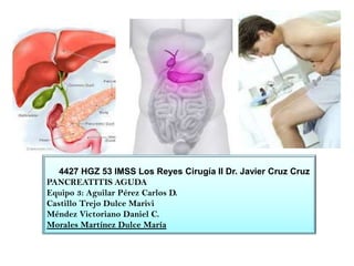 4427 HGZ 53 IMSS Los Reyes Cirugía II Dr. Javier Cruz Cruz
PANCREATITIS AGUDA
Equipo 3: Aguilar Pérez Carlos D.
Castillo Trejo Dulce Marivi
Méndez Victoriano Daniel C.
Morales Martínez Dulce María
 