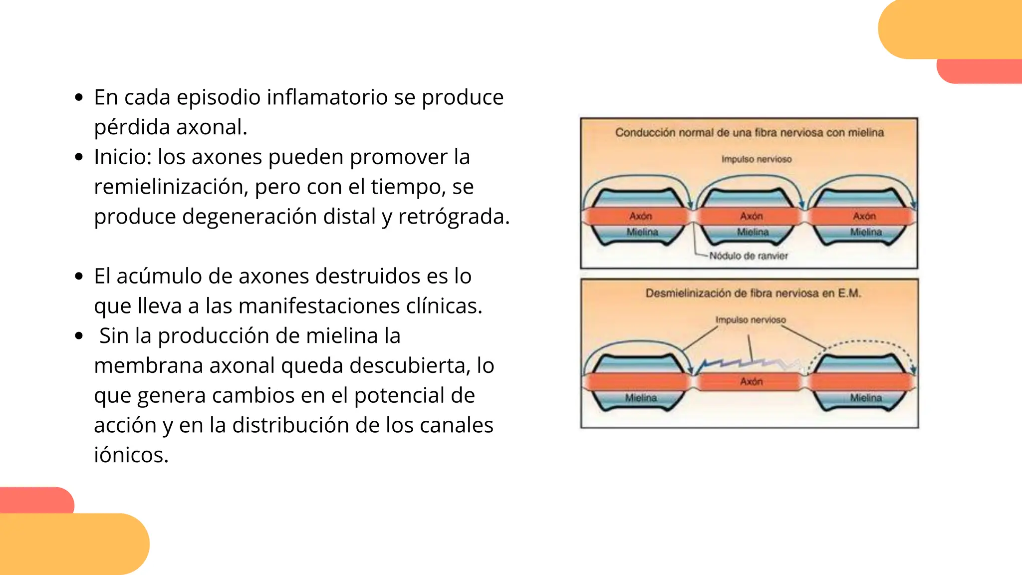 En cada episodio inflamatorio se produce
pérdida axonal.
Inicio: los axones pueden promover la
remielinización, pero con el tiempo, se
produce degeneración distal y retrógrada.
El acúmulo de axones destruidos es lo
que lleva a las manifestaciones clínicas.
Sin la producción de mielina la
membrana axonal queda descubierta, lo
que genera cambios en el potencial de
acción y en la distribución de los canales
iónicos.
 