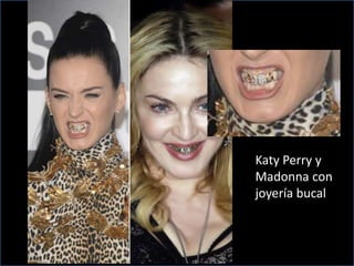Katy Perry y
Madonna con
joyería bucal
 